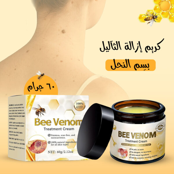 كريم إزالة الزوائد الجلدية (الثآليل) بسم النحل 60 جرام